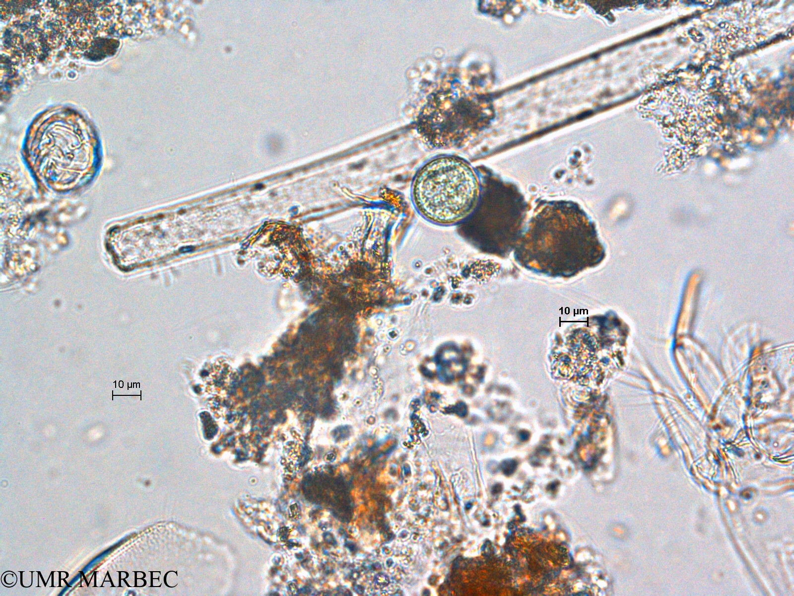 phyto/Scattered_Islands/europa/COMMA April 2011/Chroococcus turgidus (ancien C. sp8 -2)(copy).jpg